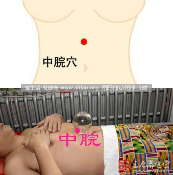 中脘穴位于腹部正中線(xiàn)，臍上4寸的位置上。每天艾灸10-15分鐘，能有效緩解胃部不適的癥狀，同時(shí)有助于祛濕。